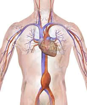 What is an Abdominal Aortic Aneurysm